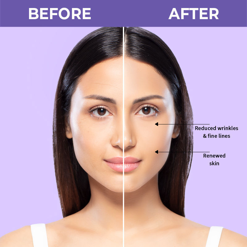 Nykaa SkinRX 2% Advanced Retinol Night Face Serum - Jusskincare