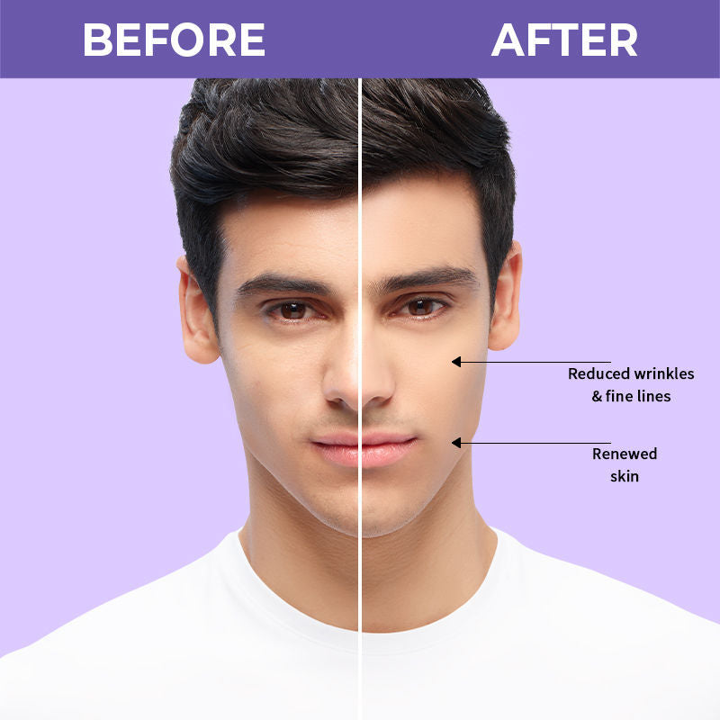Nykaa SkinRX 2% Advanced Retinol Night Face Serum - Jusskincare