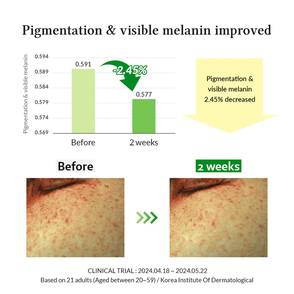Dr.Althea Gentle Vitamin C Serum | Gentle on Skin For Even Skin Tone | Korean Vegan Skin Care for All Skin Types
