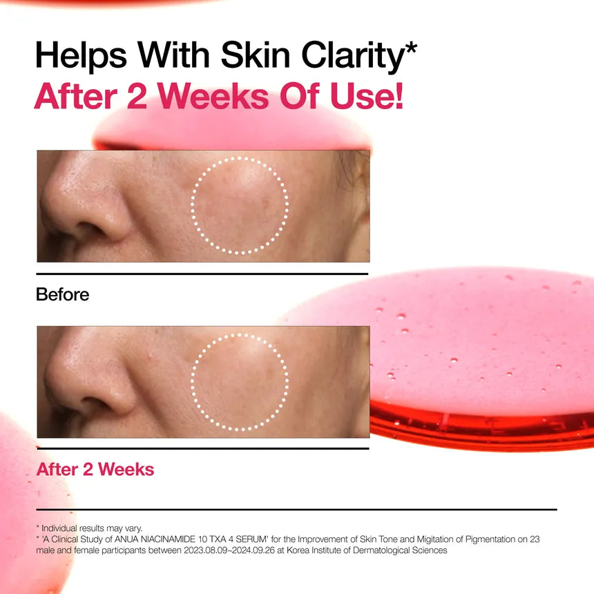 ANUA Niacinamide 10% + TXA 4% Serum 30ml ANUA