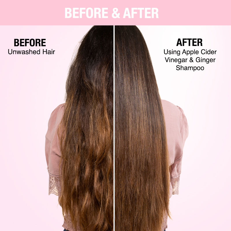 Nykaa Naturals Anti-Dandruff Sulphate-Free Shampoo with Apple Cider Vinegar, Ginger & Tea Tree Oil