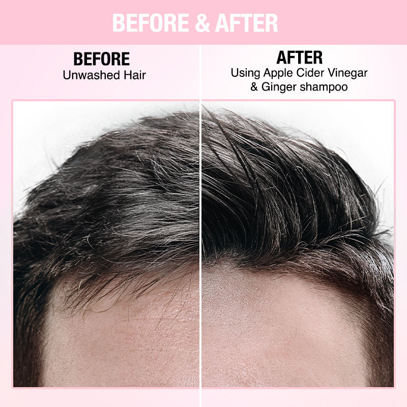 Nykaa Naturals Anti-Dandruff Sulphate-Free Shampoo with Apple Cider Vinegar, Ginger & Tea Tree Oil