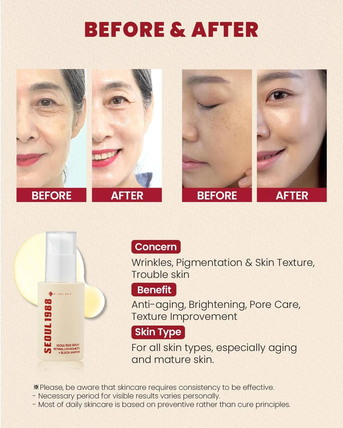 KSECRET - SEOUL 1988 Serum : Retinal Liposome 2% + Black Ginseng [30ml]
