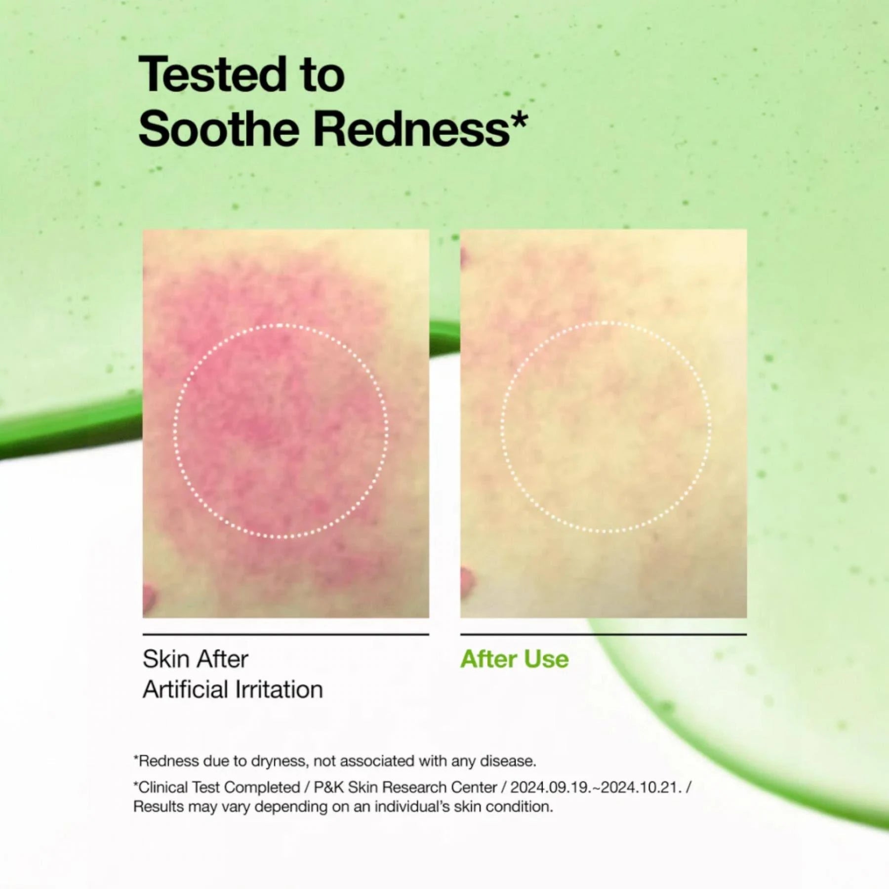 Anua - Azelaic Acid 10 Hyaluron Redness Soothing Serum [30ml] Anua